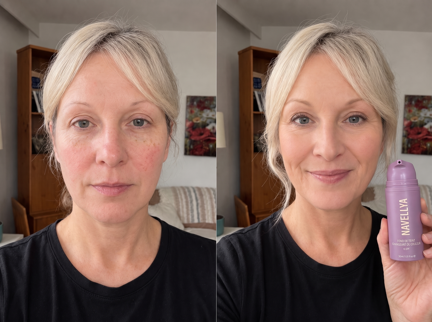 Chantal M. avant et après